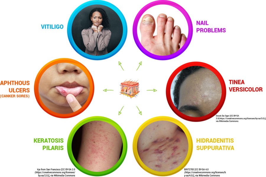 Other Dermatological Problems